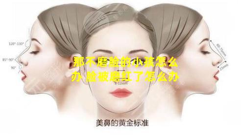 那不磨脸的小孩怎么办 脸被磨红了怎么办